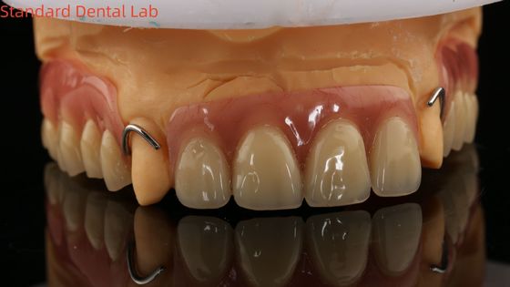 acheter Laboratoire dentaire de prothèse partielle d'acrylique Ivoclar à traitement thermique haute précision avec modèle d'impression 3D fabrication en ligne