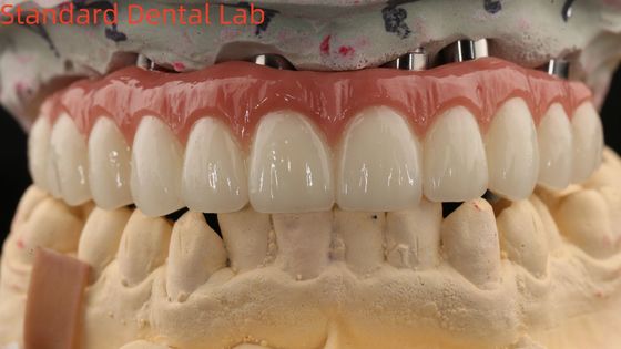 acheter Porcelaine tout sur quatre pont de zirconium haute esthétique pont d'implant dentaire vis retenue fabrication en ligne