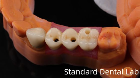 acheter Laboratoire dentaire professionnel de la couronne d'implant dentaire en zircone en titane CAD CAM fabrication en ligne