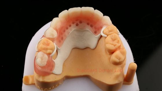 acheter Peek Conception de cadre partiel ISO CE et FDA Laboratoire dentaire cadre de prothèse partielle acrylique fabrication en ligne