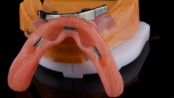 acheter Ivoclar Dental Digital Implant Bar Prothèse dentaire avec pièces jointes Prothèse acrylique complète Prothèse en titane Prothèses dentaires avec support d' implant fabrication en ligne