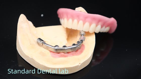 acheter Prothèses dentaires avec implant en titane Prothèses dentaires ivoclaires précises sur les implants fabrication en ligne