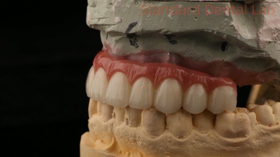 acheter Croix d'implant dentaire hybride en titane à vis tout sur 4 pont d'implant dentaire en zirconium fabrication en ligne