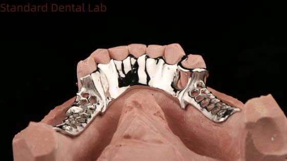 acheter Cadre en métal coulé cobalt chrome Prothèses dentaires partielles avec tablier inférieur Design SDL Dental Lab fabrication en ligne