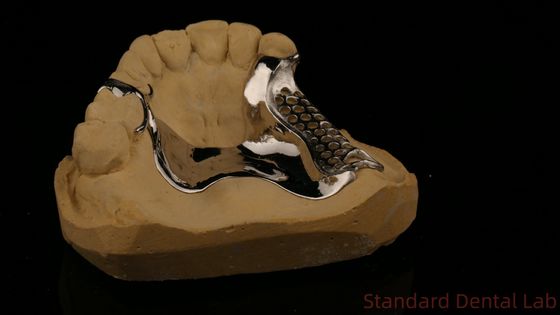 acheter Cadre en fonte imprimé 3D haute résistance COCR Prothèses partielles Chrome Cobalt Cadre en métal fondu fabrication en ligne