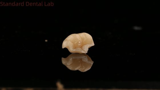 acheter Forteur Emax couronne en céramique dentelle avec une excellente résistance aux taches fabrication en ligne