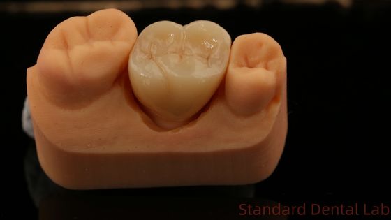 acheter La couronne en zirconium, laboratoire dentaire chinois fabrication en ligne