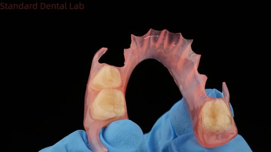 acheter Modèle d'impression 3D dentaire TCS Valplast Dentures partielles flexibles de couleur rose / foncée Produit de laboratoire dentaire fabrication en ligne