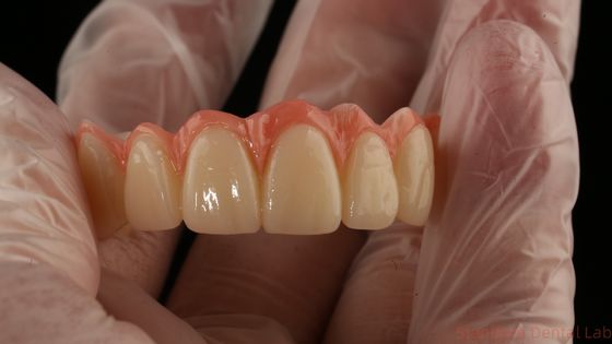 acheter Porcelaine tout sur quatre Pont de zirconium Haut esthétique Pont d'implant dentaire fabrication en ligne
