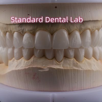 Laboratoire dentaire couronnes en porcelaine en zirconium à arc complet couronne PFZ ISO FDA CE