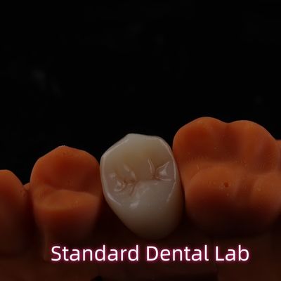 BruxZir esthétique haute couronne de zirconium de contour complet pont PFZ