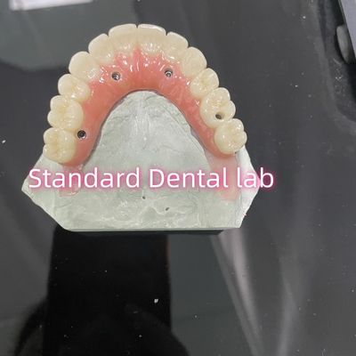 Tout sur quatre six Ivoclar Zirconia Implant Bridge Bar de titane avec de la porcelaine de gomme rose