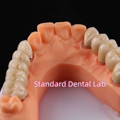 Dentistique à base de porcelaine en métal non précieux
