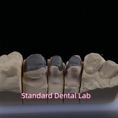 Métal coulé post-core couronne Cocr Rétentive précis complet Zirconia Bruxier