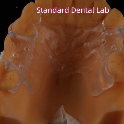 Des claviers de prothèses partielles en acrylique clair amovibles qui conservent leur apparence naturelle