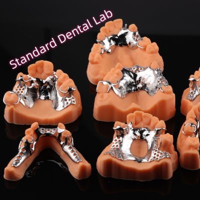 CAD CAM cadre métallique de prothèse partielle amovible 3Shape