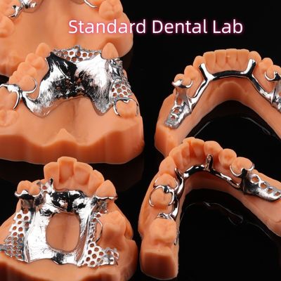 Denture CoCr Imprimée Esquelette Denture Partielle en Chromes Métaux