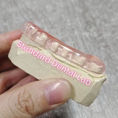 Bruxisme dentaire occlusal étreinte de garde de nuit Laboratoire dentaire standard