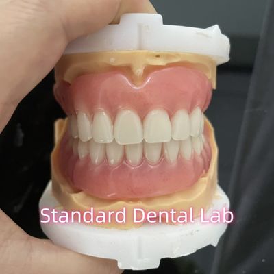 Laboratoire dentaire standard OEM Prothèses dentaires entièrement amovibles faciles à retirer et à retirer