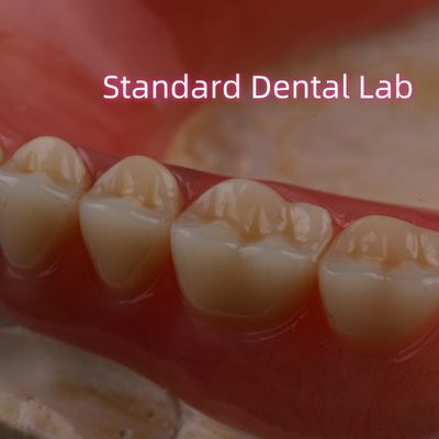 SDL Prothèse partielle acrylique à durcissement thermique Ivoclar Dents Laboratoire dentaire haute précision