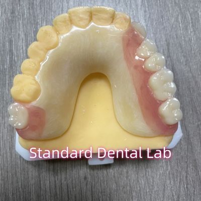 Dentition partielle en acrylique avec fermeture