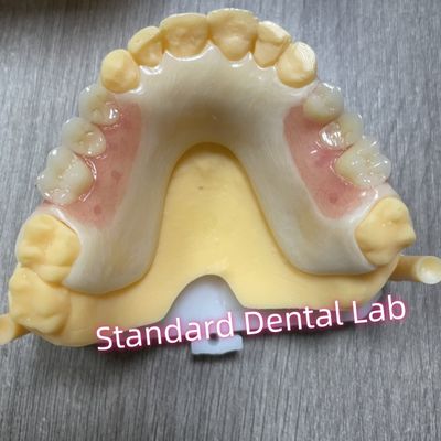 Rameau acétallique de l'ombre des dents supérieures