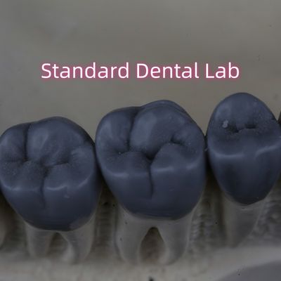Le laboratoire dentaire numérique professionnel a été approuvé par la FDA.