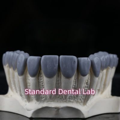 Laboratoire dentaire standard La couronne dentaire en cire haute esthétique