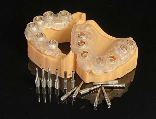 Guide de chirurgie 3D pour les implants dentaires