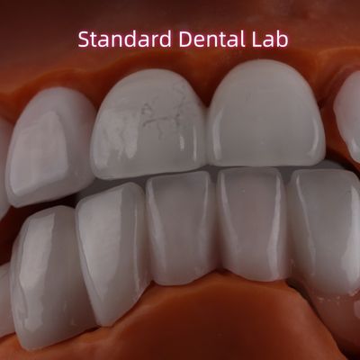Lithium Dicilicate couche Ivoclar Emax Zirconia placage stratifié Translucide OEM ODM