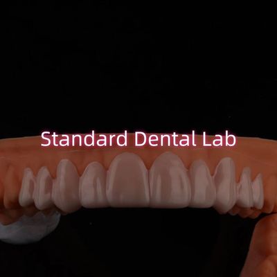 Appareils dentaires pour le sourire pour les dents décolorées ou creuses