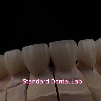 Pont en zirconium céramique à couches dentaires PFZ avec incision translucide