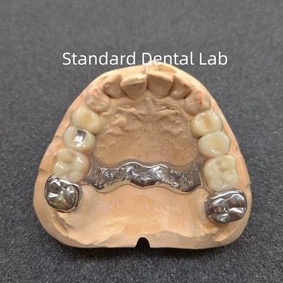 Précisité amovible Dentistique Prothèse partielle Stable Professionnel