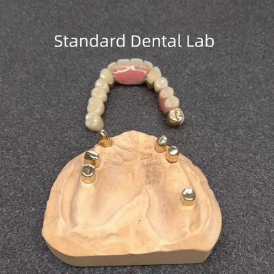 CAD CAM Prothèse partielle de la dent Accompagnement professionnel dentaire Précise