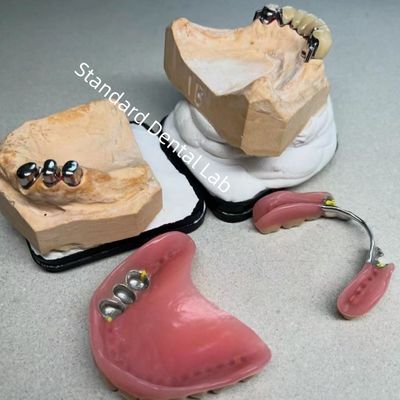 L'esthétique de haute qualité CAD CAM Dent partielle Denture de remplacement