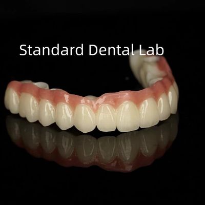 Porcelaine esthétique monolithique couronne de zirconium translucide à pleine arche