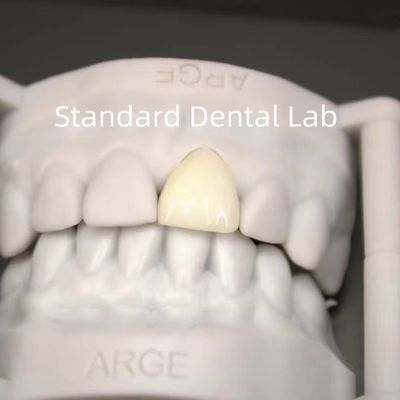 Couronnes de laboratoire dentaire numérique CAD CAM Translucide couronne en zirconium en couches