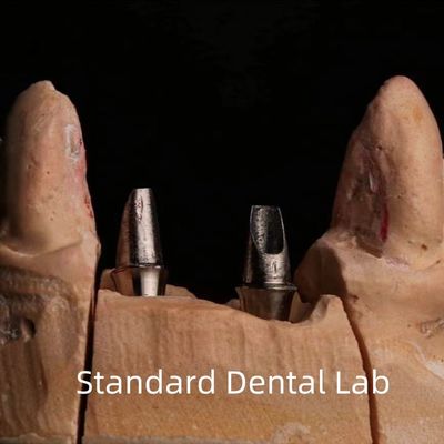 Porcelaine dentaire couronne d'implant de zirconium haute esthétique professionnelle