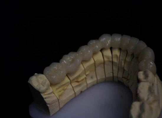 Zirconium fondu en porcelaine en couches