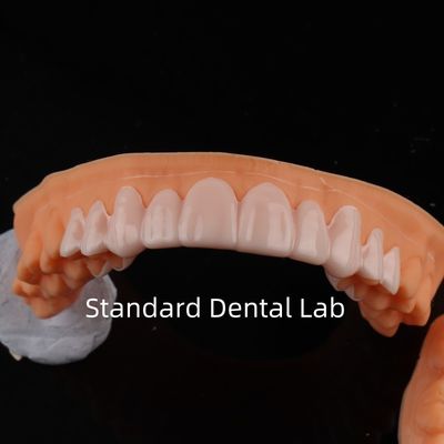 Lab dentaire standard de haute esthétique
