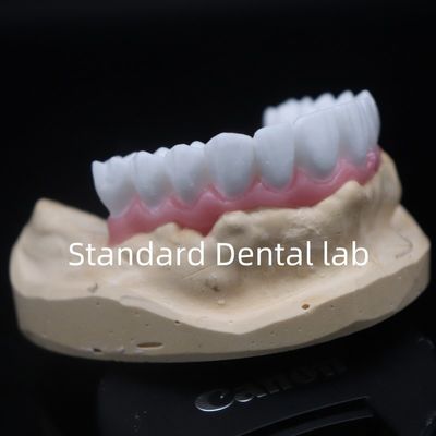 La couronne dentaire blanche de haute esthétique, la cirée diagnostique personnalisée, laboratoire dentaire chinois