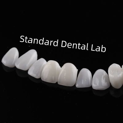 Dents de haute esthétique Émax placage stratifié Translucide incisive