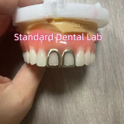 Dentures en acrylique complète ISO avec des dents d'or jaune
