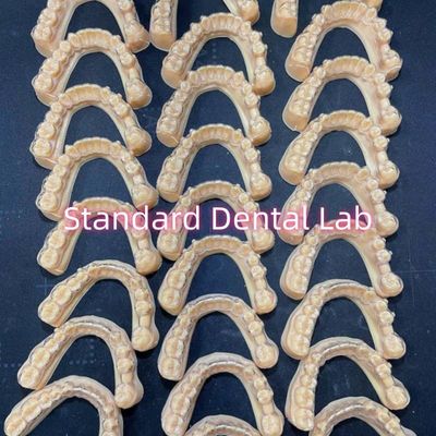 Dentiste professionnel orthodontique Invisalign Plan de traitement des retenus clairs