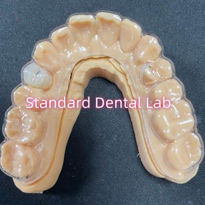 Détenteur professionnel d'orthodontie Détenteurs Essix clairs avec des dents de résine acrylique stables