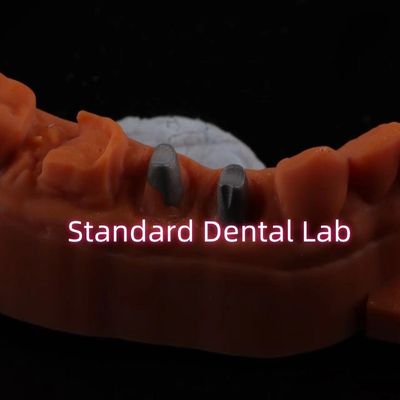 Couronne métallique post-cœur CAD CAM Porcelaine / Zirconia Coping couronnes de Zircnonia bruxier complètes