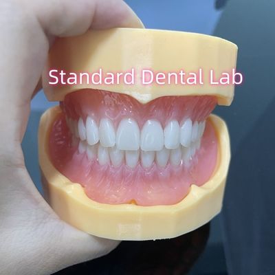 Dentures acryliques supérieures et inférieures de haute esthétique