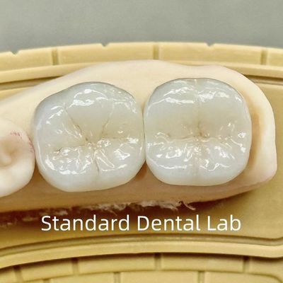 Des couronnes de laboratoire dentaire translucides en zirconium de contour complet avec une résistance supérieure
