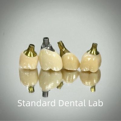 Professionnel en zirconium à vis implanté en titane couronne CAD CAM