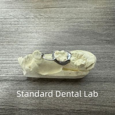 Mainteneurs de l'espace dentaire professionnels de l'orthodontie